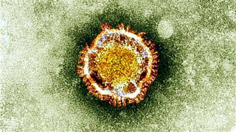 Le nouveau coronavirus sous surveillance Image accompagnant la nouvelle