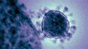 L'OMS prévient que le coronavirus pourrait se transmettre d’une personne à l’autre