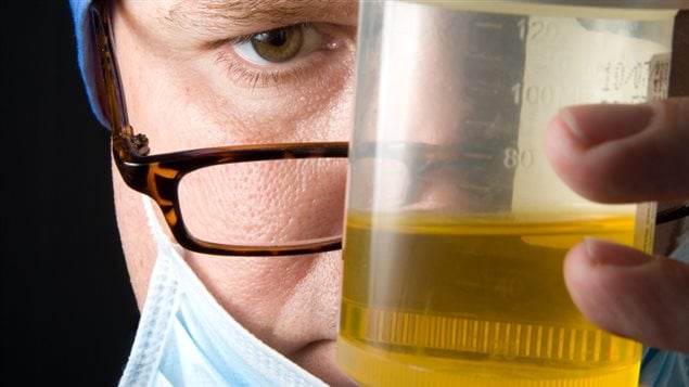 Un médecin regarde un échantillon d'urine