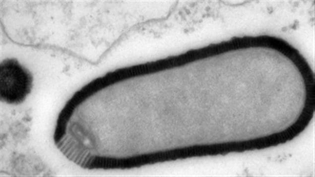  Virus géant trouvé dans du pergélisol de 30 000 ans et qui a réussi à infecter une amibe lorsque ranimé