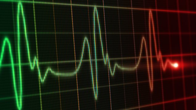 Un moniteur cardiaque Un moniteur cardiaque