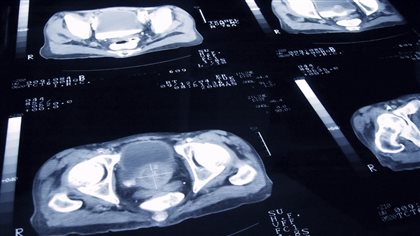 Le CSSS de Rimouski-Neigette rappellera 1600 patients - ICI.Radio-Canada.ca