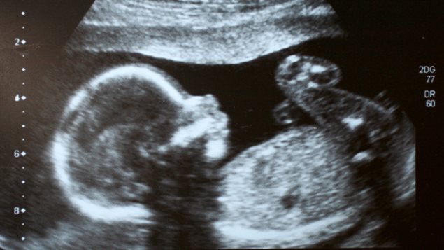 Un bébé dans le ventre de sa mère