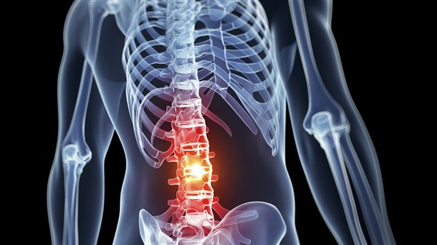 Un sondage d'Ostéoporose Canada révèle que les Canadiens ignorent les faits sur l'ostéoporose et sur ses conséquences sérieuses sur la santé