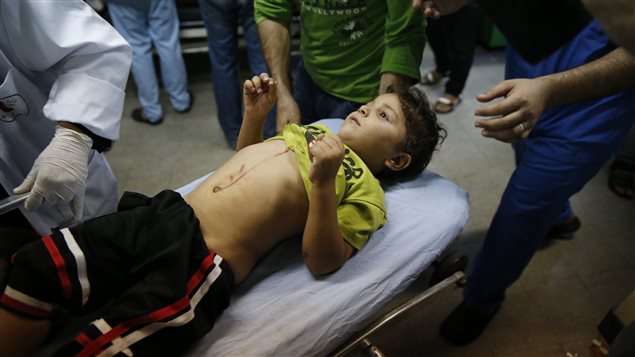 Un enfant blessé par le tir d'un obus sur une école de l'ONU servant d'abris pour les civils palestiniens est évacué par les secours.