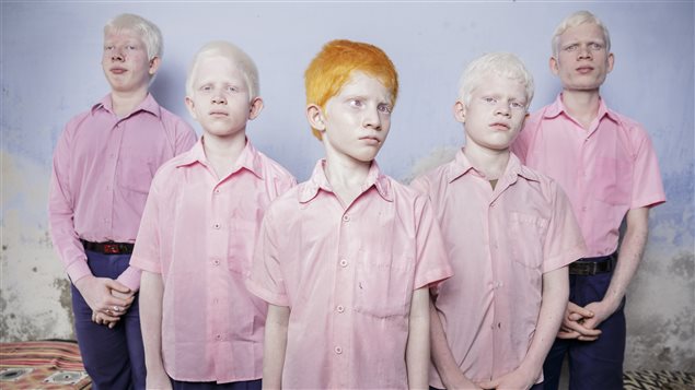 Premier prix du World Press Photo dans la catégorie Portraits posés. Élèves albinos aveugles dans un dortoir de l’école de mission Vivekananda, internat pour non-voyants au Bengale occidental, Inde.