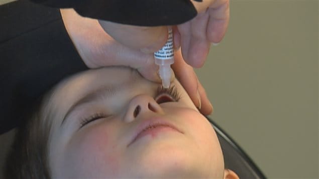 Un enfant reçoit un traitement sous forme de goutte dans l'oeil gauche.