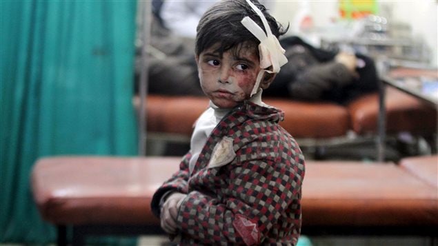 طفل جريح في مستشفى ميداني في دوما قرب دمشق يوم الأربعاء عقب غارات جوية وقصف مدفعي من قبل القوات الحكومية حسب ما أفاد به ناشطون معارضون