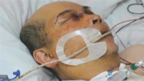 Police took the unusual step of releasing a photo of the 59 year old man to show how badly he had been beaten in the 2014 online sale gone wrong.