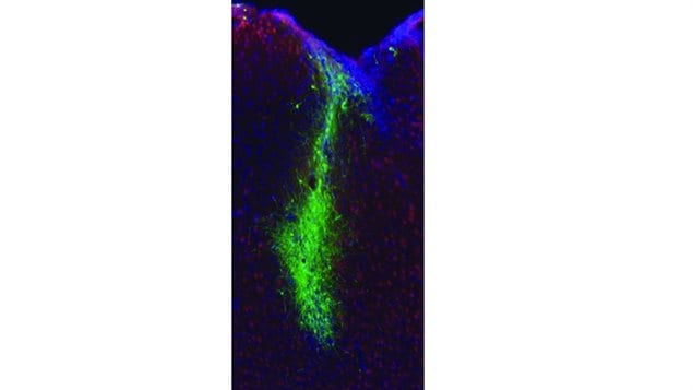 Neural stem cells (fluorescently green) in the hydrogel (HAMC – hyaluronan/methylcellulose) in a model stroke-injured mouse brain – this figure demonstrates a lovely distribution of cells in the brain and great survival of those cells – this led to improved motor function back to baseline levels pre-injury.