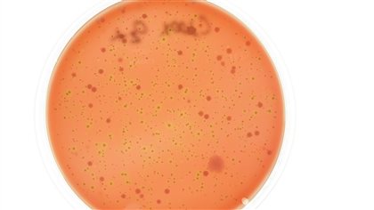 Bacteria plate prepared from a patient's stool sample. Traditional infection testing requires tens of thousands of infected cells, specialized equipment and possibly days. The new technology at McMaster eliminates those issues.