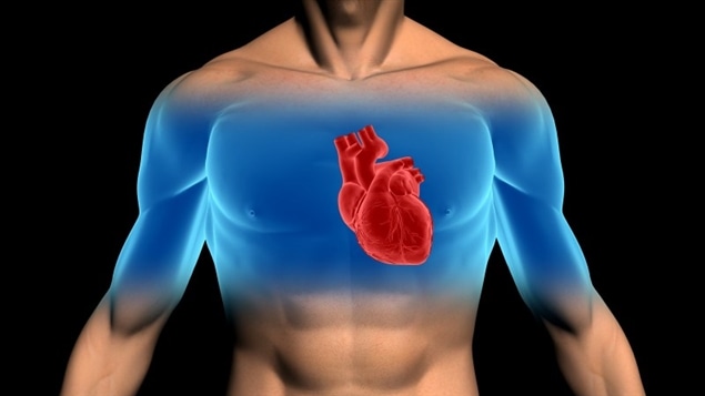 Plus de 600 000 Canadiens sont touchés par l'insuffisance cardiaque, c'est ce qu'a révélé hier l'Institut de Cardiologie de Montréal. On en parle avec Sébastien Bergeron, cardiologue à l'Institut universitaire de cardiologie et de pneumologie de Québec.