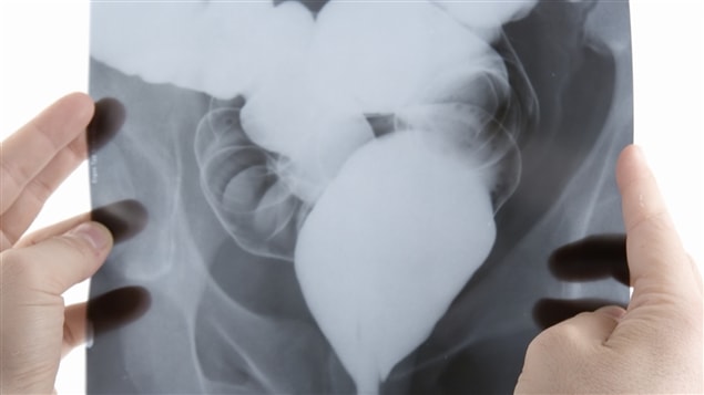 Radiografía de los intestinos