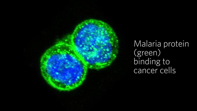 electron microscope image showing clearly how the malaria protein actively seeks out and binds to the cancer cells. When combined with the toxin, it becomes a targetted treatment leaving healthy cells unaffected while killing hte cancerous cells.