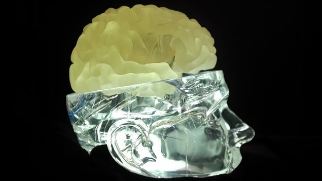 Le modèle 3D d'un cerveau permet aux chirurgiens de se pratiquer avant une chirurgie complexe. 