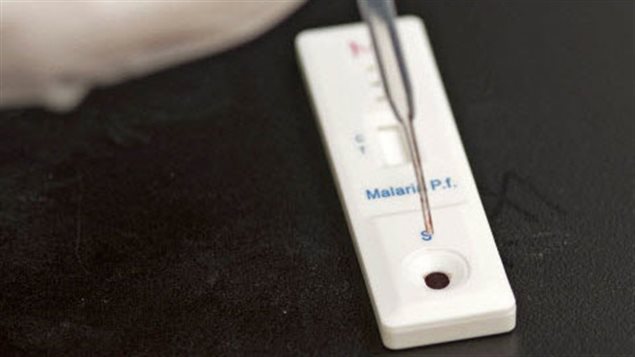 Prueba de sangre para detectar la presencia del virus de la malaria. 