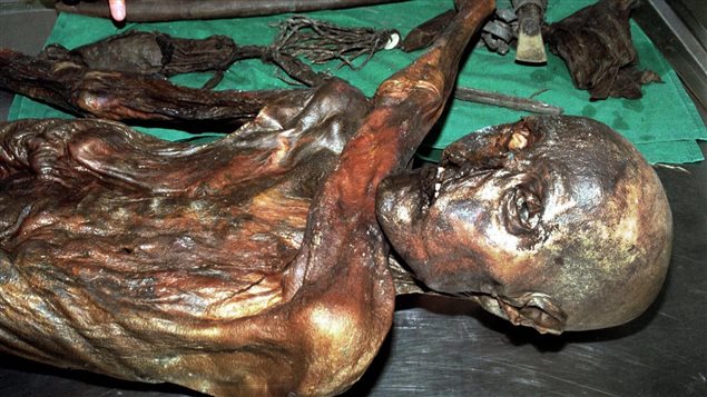 Otzi, el hombre de hielo.