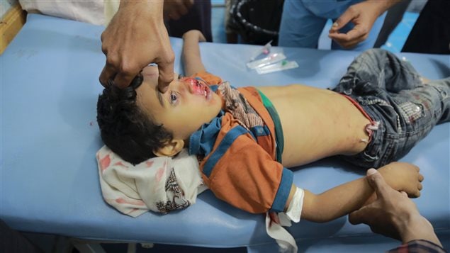  A medic attends to a boy injured by Houthi shelling in Yemen’s southwestern war-torn city of Taiz December 30, 2015.