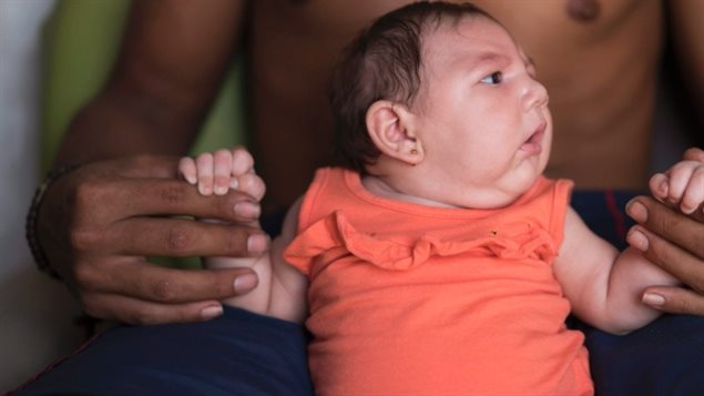 Un homme tient dans ses mains, Luiza, sa fille brésilienne qui est née en octobre avec une maladie rare appelée microcéphalie (petit cerveau). (Felipe Dana / Associated Press)