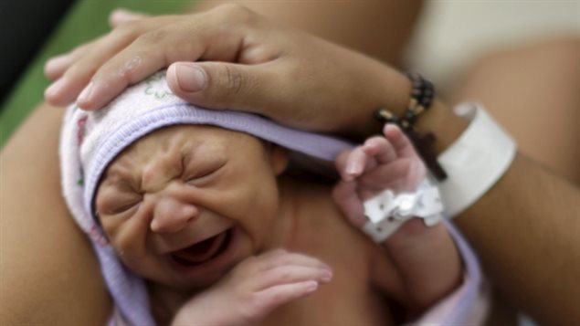 Niño con microcefalia y otras anormalidades neurológicas en América Latina.