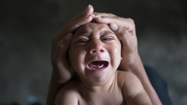  In this Jan. 30, 2016 photo, Elielson tries to calm down his baby brother Jose Wesley, in Bonito, Pernambuco state, Brazil. Jose Wesley was born with microcephaly and he screams uncontrollably for long stretches, getting red in the face and tightening his already stiff limbs.