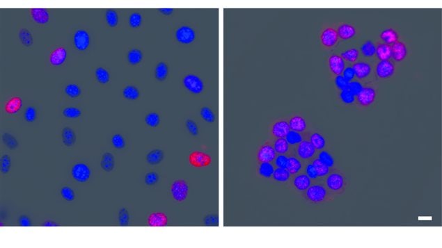 *Human cells divide at a higher rate when cultured in physiological oxygen levels (right) when compared to atmospheric oxygen levels (left). The nucleus of each cell is colored blue, while the dividing cells are also colored red. Scale bar, 10 micrometers.