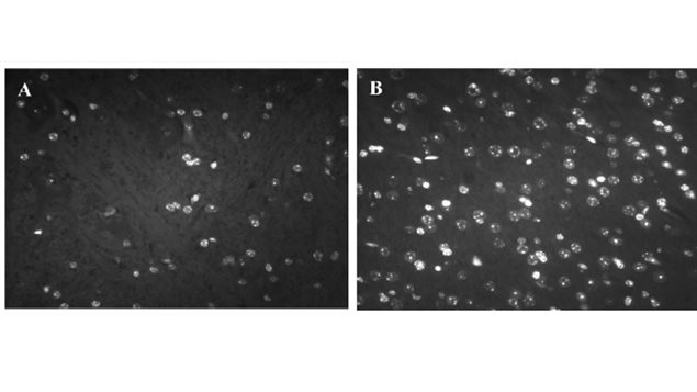 Brain sections with DAPI stained nuclei at 630x magnification. (A) 12-month-old control TGM (no given the supplement and showing brain-cell deterioration (B) 12-month-old supplemented TGM showing meny more brain cells still alive and active