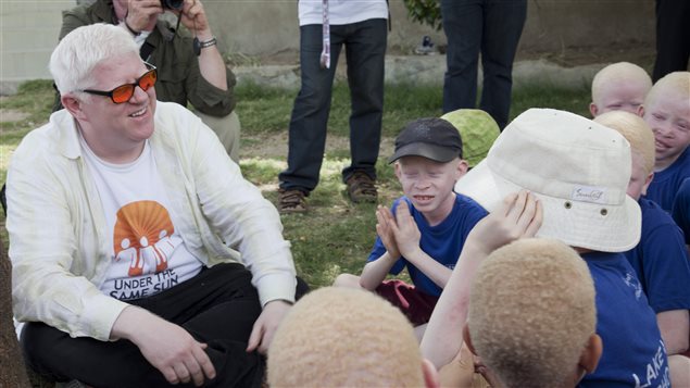 Canadian Peter Ash visits children at Lakeview School in northern Tanzania in 2013 to talk about albinism.