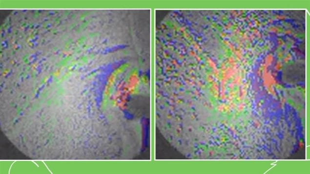 Scans of rat brains showing reactions to stress hormone CRF. The normal mouse at left, and the epileptic mouse at right