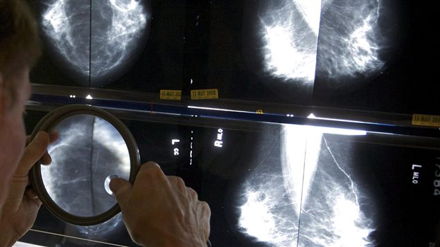 Several studies have found a link between obesity and breast cancer.