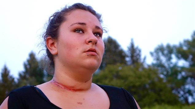 Taylor Yach was riding an all-terrain vehicle on private property when she hit a cable strung across the dirt road.