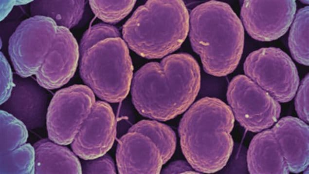 Gonorrhea bacteria. The World Health Organization has issued new guidelines for treatment of sexually transmitted diseases as they build up resistance to antibiotics