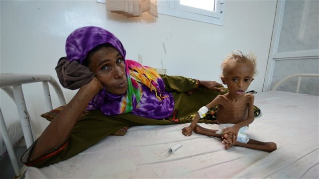 Una mujer con su hijo malnutrido en un hospital en la ciudad portuaria de Houdieda, Yemen en la costa del Mar Rojo /  Septiembre, 2016. 