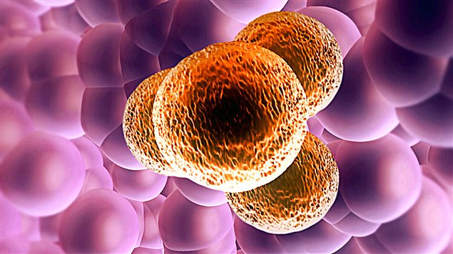 Une cellule cancéreuse