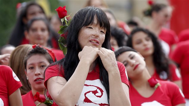 Patricia Espitia (C), an acid attack victim, performs during a march to commemorate International Day for the Elimination of Violence Against Women, in Bogota, November 25, 2015. 