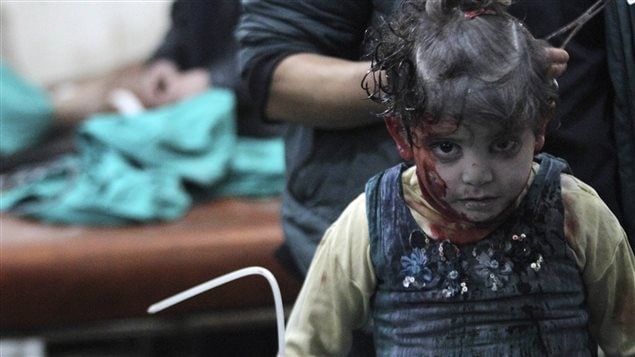 An injured girl waits for treatment in a field hospital after what activists said was an airstrike by forces loyal to Syria’s President Bashar al-Assad in the Duma neighbourhood of Damascus January 28, 2015.