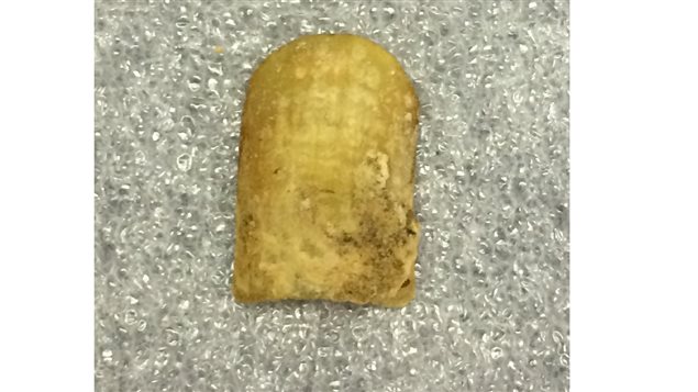 The thumbnail of able seaman John Hartnell. As the nail grows it keeps a record of what kind of nourishment the body is recieving. The tip of the nail would represent the beginning of the voyage, while the section under the cuticle would show the state of his body as he was dying.