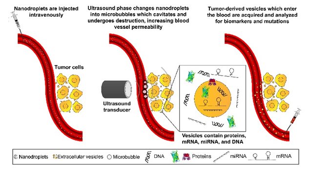 Overview of ultrasound-mediated tumor EV release. Before tumor sonication, nanodroplets are injected intravenously. High pressure ultrasound is applied to tumor cells which phase-changes nanodroplets into microbubbles 