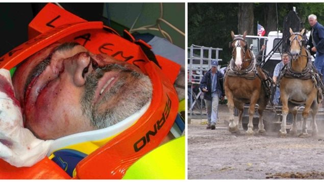 Calvin Stein’s injuries being treated on July 9, 2016 / Horse pull at Tweed Fair, 2007 (Calvin Stein / Twitter)