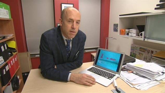 Dr. Michael Hill who helped develop thrombectomies shows pieces of a blood clot removed from a 31-year-old stroke patient.