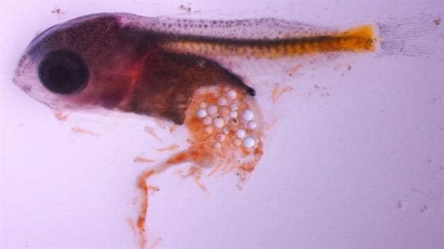 Microbeads in a larval perch gut. Plastics in the guts have been known to lead to the deaths of all kinds of marine creatures from tinay larval fish, to whales, seabirds, tortoises and seals.