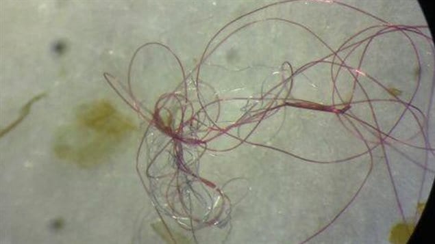 Exceedingly fine plastic fibres found inside the body of a Great Lakes fish. The synthetic fibres are from garments, cleaning cloths etc during normal washing. This is in addtion to the tiny bits from plastic bags and bottles as they are broken down into smaller and smaller bits.