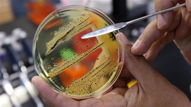 The World Health Organization has issued a list of the top dozen bacteria most dangerous to humans, warning that doctors are fast running out of treatment options. In a press briefing on Monday, Feb. 27, 2017 the U.N. health agency said its list is meant to promote the development of medicines for the most worrying drug-resistant bacteria, including Salmonellae and Staphylococus aureus.