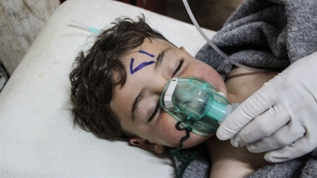 A Syrian child is treated after the chemical attack in Syria’s Idlib province.