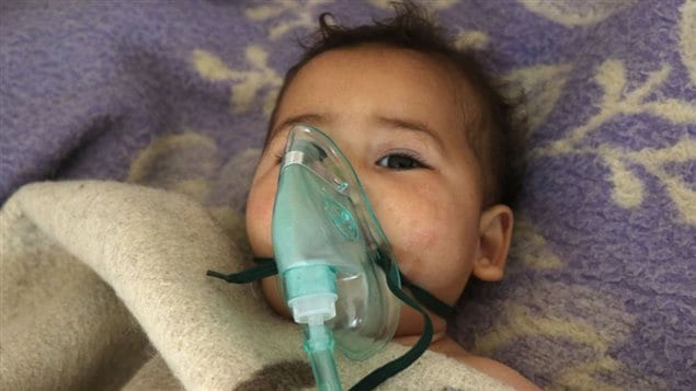A Syrian child receives treatment at a small hospital in the town of Maaret al-Noman following a suspected toxic gas attack in Khan Sheikhun, a nearby rebel-held town in Syrias northwestern Idlib province, on April 4, 2017.