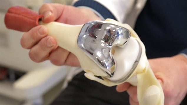 Can Damaged Knee Cartilage Repair Itself