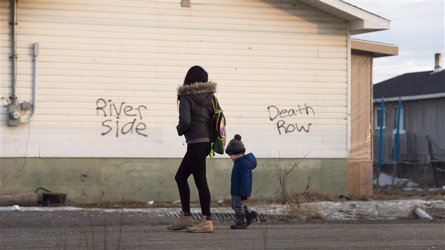 Rates of tuberculosis in Indigenous communities is 30 times higher than the Canadian average while among Canada’s Inuit the rates are a staggering 300 times higher than in non-Indigenous Canadians, according to Health Minister Jane Philpott.