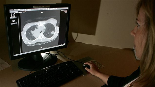 Radiology technologist Mary McPolin looks at a CT scan of a lung with a tumor at the UCSF Comprehensive Cancer Center August 17, 2005 in San Francisco, California. 