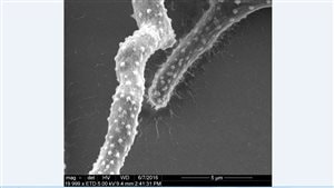 The fungus Aspergillus fumigatus produces a sticky sugar molecule (seen in this microscopic image as a speckled meshwork) in order to make its biofilm. It covers the fungus and allows it to stick to surfaces and tissues, making it difficult to remove and treat patients. Scientists from the Research Institute of the MUHC and SickKids have developed a new innovative technique aimed at destroying biofilms.Technique used: Scanning electron microscopy