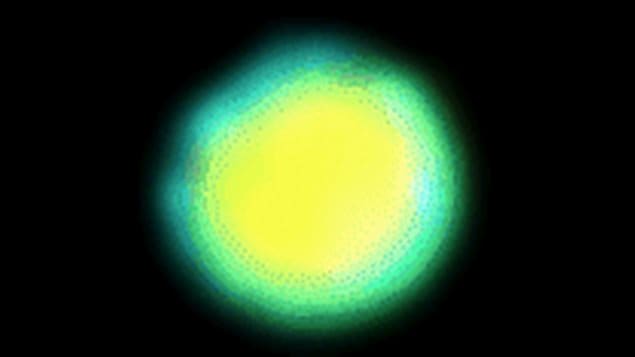 The image shows the FOXP3 protein (in yellow) in the nucleus of an activated human T lymphocyte  cell from peripheral blood. Technique used: Confocal microscopy-flow cytometer